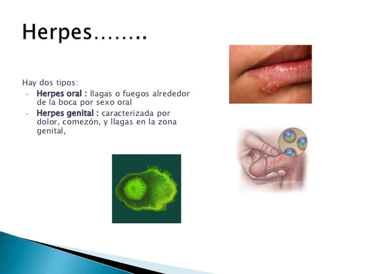 Riesgo de contraer otras infecciones